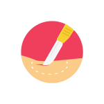 جراحة بطن و غدد صماء