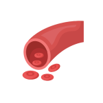 توسيع صمامات القلب