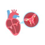 إصلاح عيوب القلب الخلقية