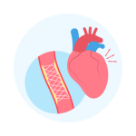 تركيب قسطرة تشخيصية او علاجية