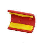 علاج إرتفاع نسبة الدهون بالدم والكوليسترول