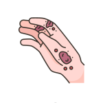 علاج ومتابعة الامراض الجلدية