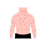 تشخيص و علاج أمراض الحساسية و المناعة للبالغين و الأطفال