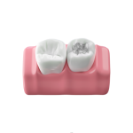 حشوات الأسنان