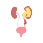 علاج العيوب الخلقيه بالمسالك البوليه عند الاطفال