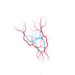 جراحة اوعية دموية للبالغين و الأطفال