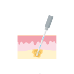 شفط الدهون والنحت رباعى الابعاد