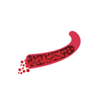 تشخيص وعلاج أمراض الدم للاطفال