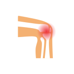 علاج خشونة المفاصل والتهاب المفاصل المناعي