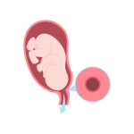 الولاده بدون الم