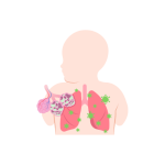 جراحة صدر اطفال