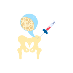 زرع النخاع و الخلايا الجزعية