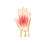 تشخيص و علاج مرض  الروماتويد المفصلي