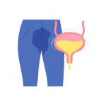 علاج واصلاح السلس البولي