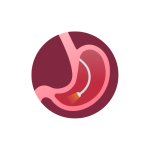 جراحة جهاز هضمي ومناظير اطفال