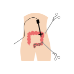 جراحة مناظير بالغين