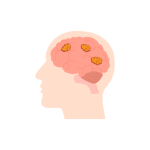 جراحة اورام المخ