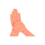 علاج حساسية الجلد