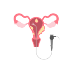 مناظير الحمل