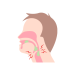 تأهيل ما بعد استئصال الحنجرة و صعوبات البلع