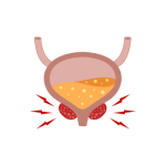 عمليات البروستاتا بالليزر