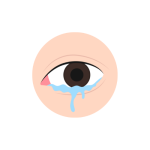 علاج فرط الدموع و مشاكل القنوات الدمعيه