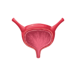تركيب الصمام الخلفى و توسيع عضله المثانه