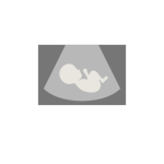 مناظير البطن والرحم