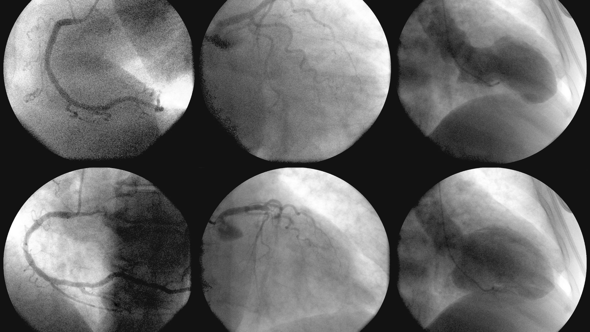 دليل شامل لتركيب القسطرة التشخيصية والعلاجية