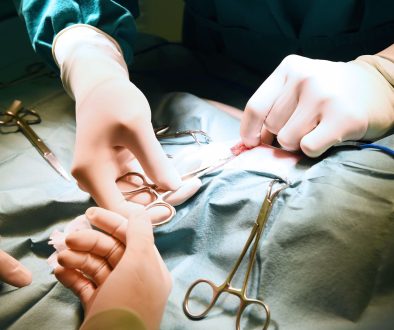 جراحة بطن و غدد صماء