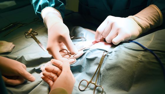 جراحة بطن و غدد صماء