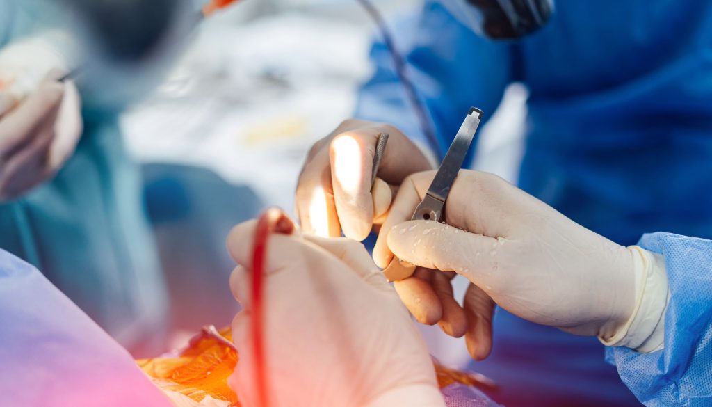 جراحة مخ واعصاب بالغين