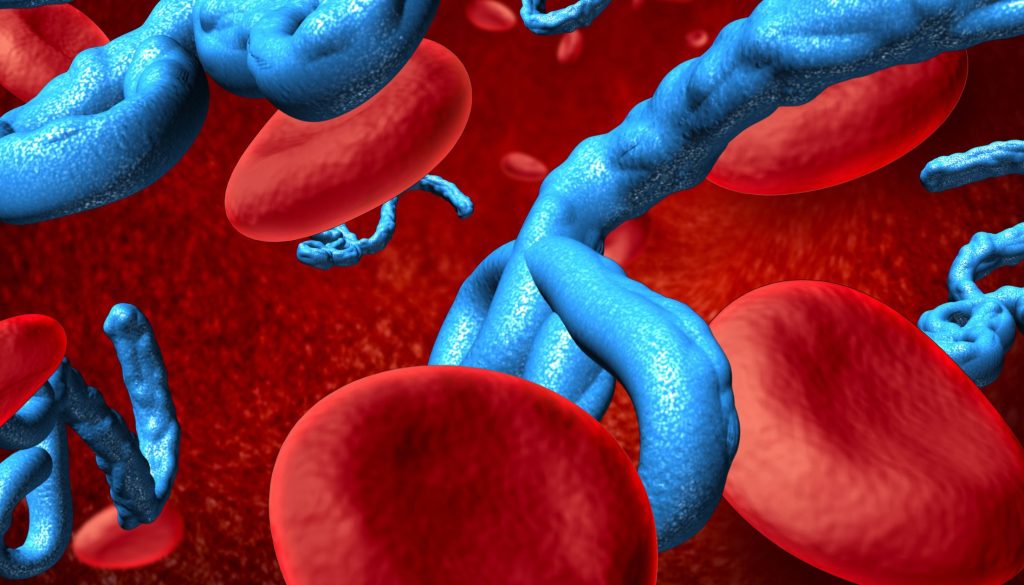 صحة مرضى أمراض الدم