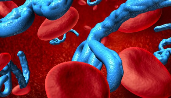 صحة مرضى أمراض الدم