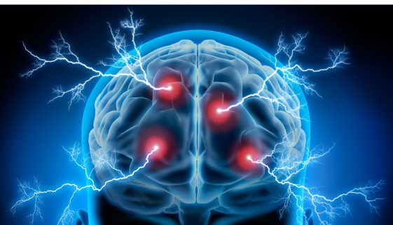 صحة المخ و الاعصاب
