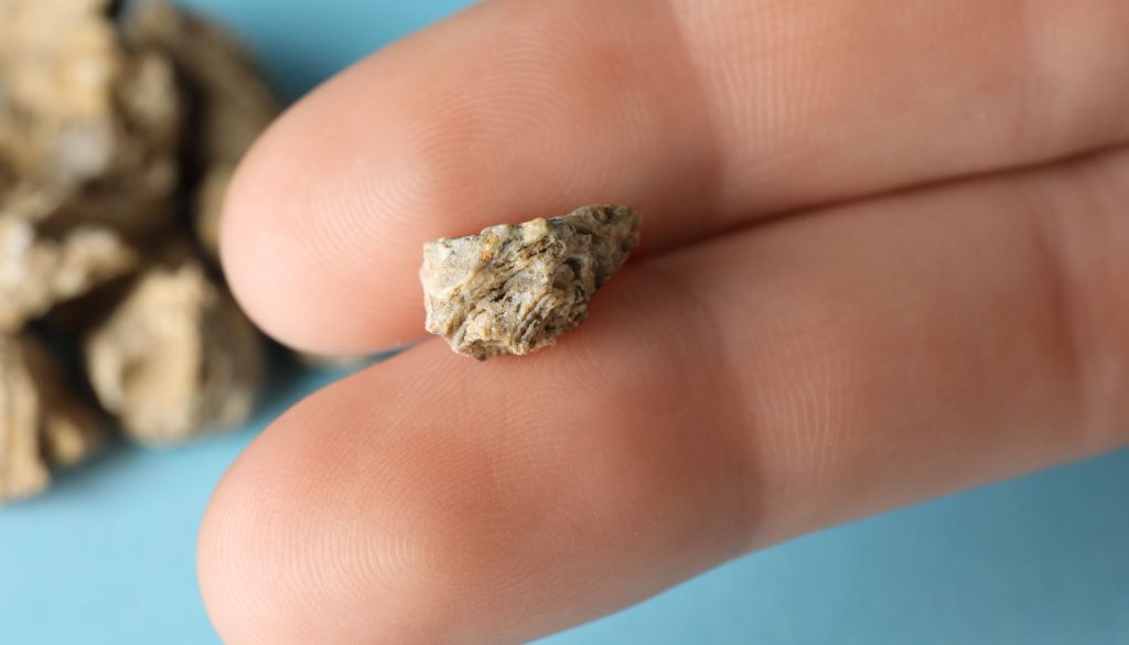 Crushing and extracting kidney, ureter and bladder stones using an endoscope