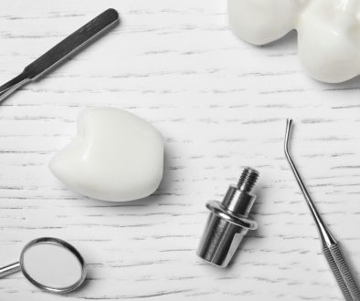 Dental implants and bridges