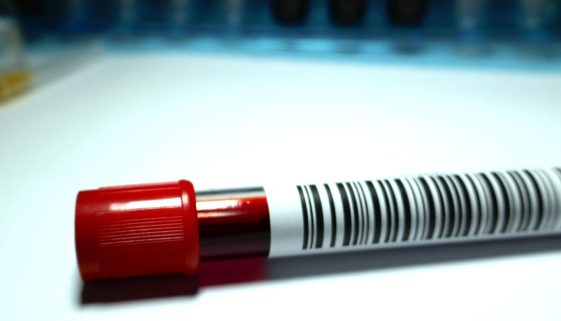 تشخيص وعلاج أمراض الدم