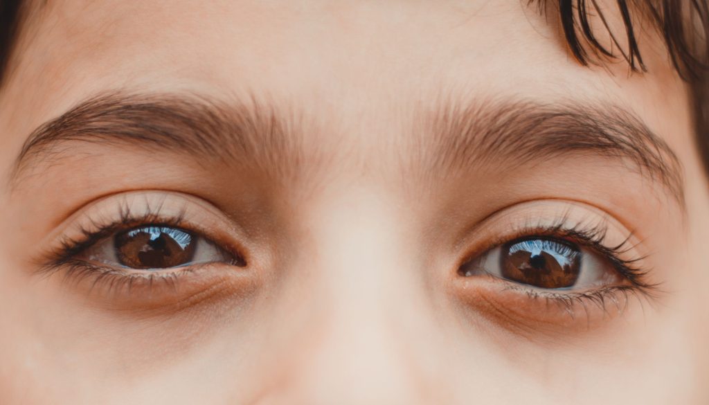 حساسية العيون