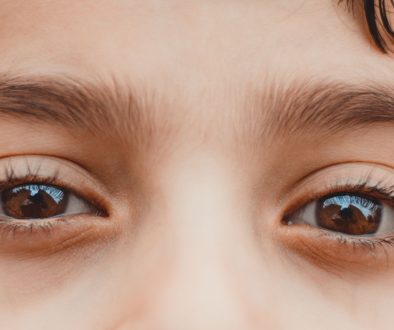 حساسية العيون