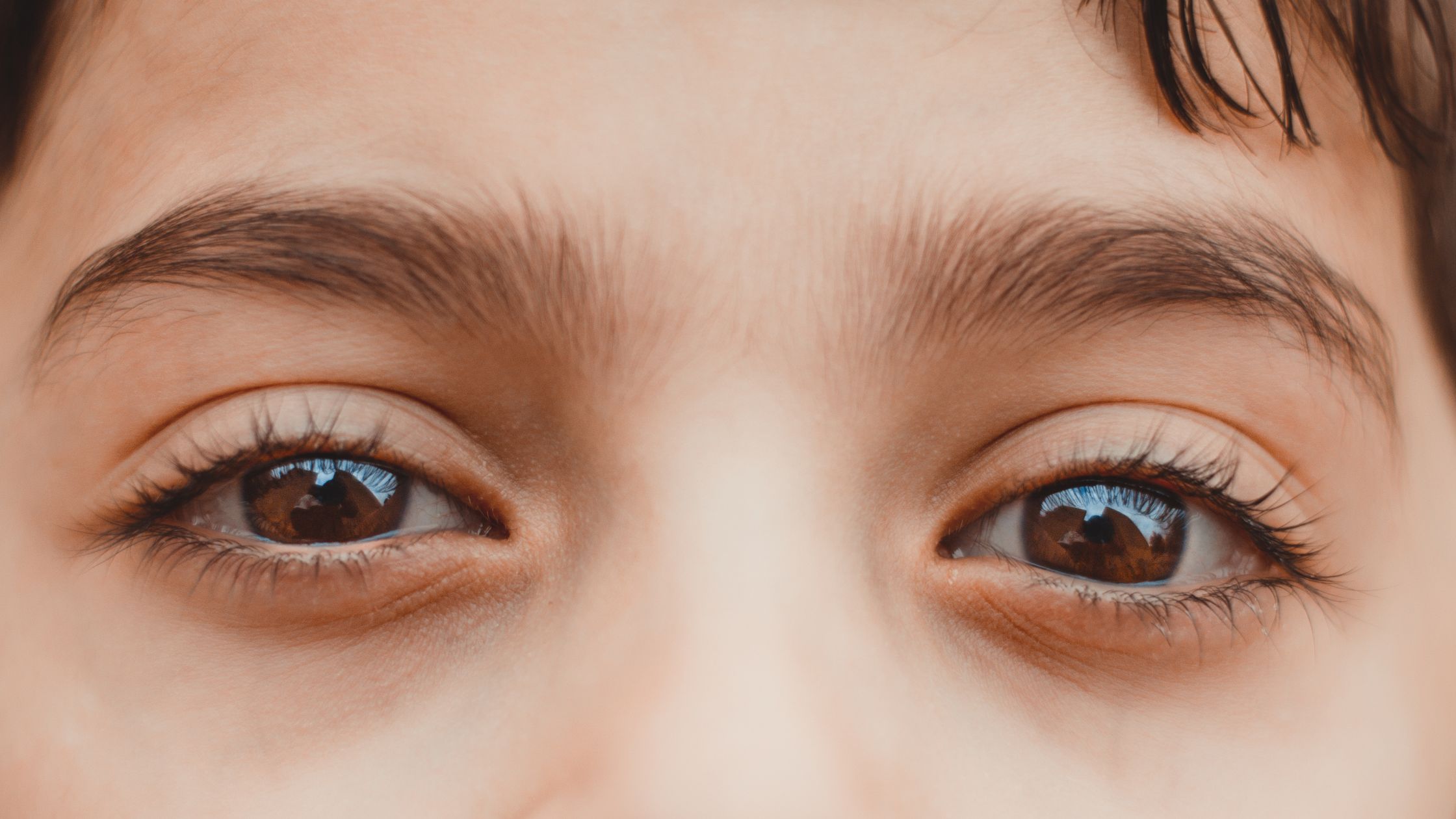 حساسية العيون