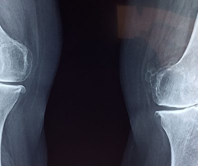 حفاظك على صحة عظامك