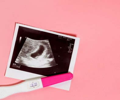 متابعة التبويض والحمل