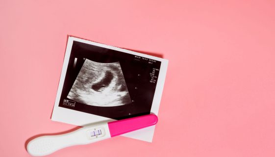 متابعة التبويض والحمل