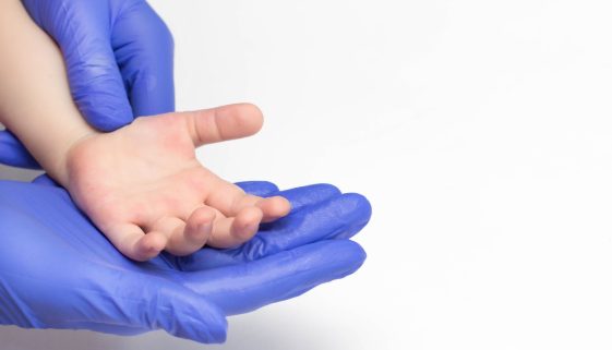 جراحة عظام اطفال