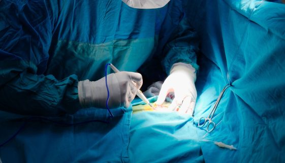 جراحة تشوهات الأطفال الخلقية