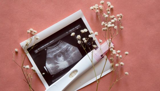 مناظير الحمل