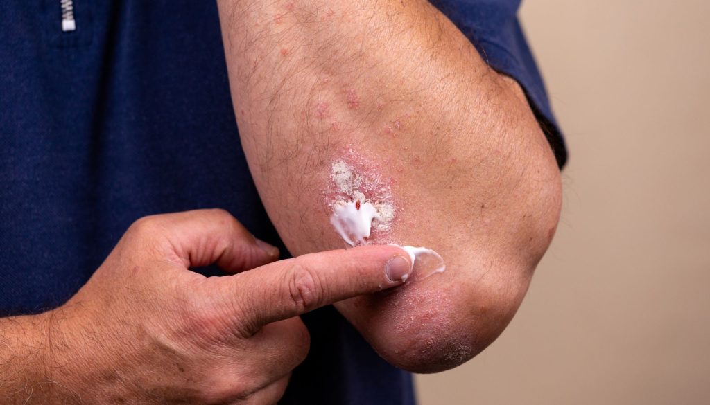 العناية بالأمراض الجلدية