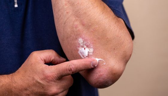 العناية بالأمراض الجلدية