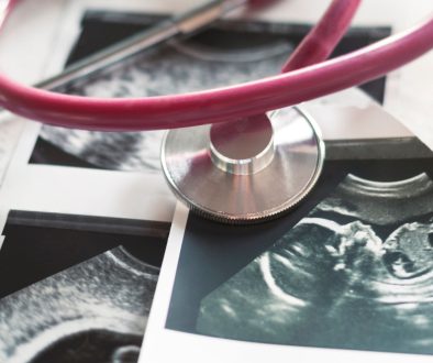 علاج تأخر الإنجاب عند النساء